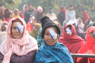 बागमतीका तीन सय ४६ जनाको मोतिया बिन्दुको शल्यक्रिया